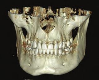 Standardní, pediatrické a segmentované panoramatické snímky, laterální TMJ a bitewingové snímky pokrývají panoramatické zobrazovací potřeby vaší ordinace.