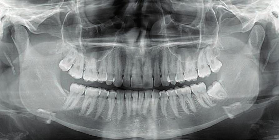 Funkce ORTHOfocus : automaticky zvolená vrstva zobrazení. Rychlý sken za 9 sekund.
