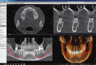 Kromě toho budete připraveni používat novou sjednocující softwarovou platformu DTX Studio * pro 2D a 3D diagnostiku, která představuje novou éru digitální integrace pracovních postupů.