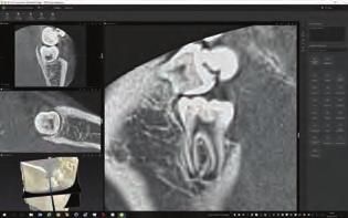 a postupně otevřít možnosti, které jste nikdy neočekávali. zubní technologie. DTX Studio je kompatibilní s operačními DTX Studio. CLINIVIEW. OnDemand3D. Jednotný pracovní 2D rentgenový software.