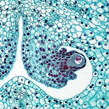Makrosporocyt = mateřská buňka megaspor