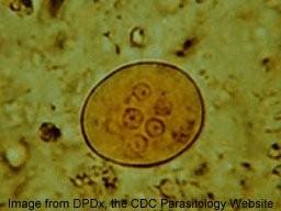 Entamoeba coli (cysta) www.