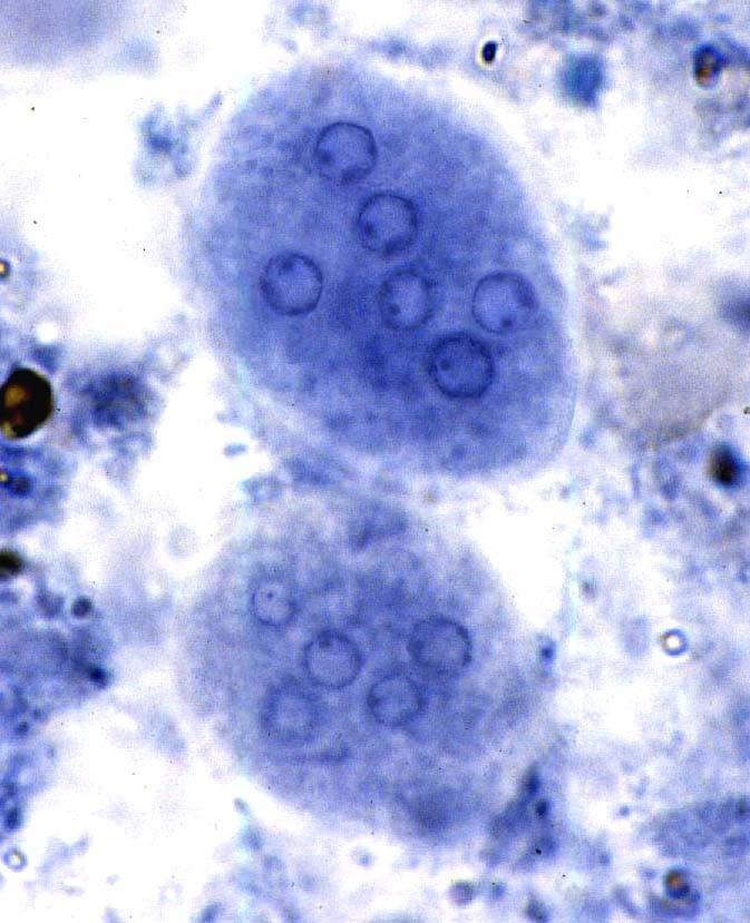 Entamoeba coli (cysta) www.ksu.