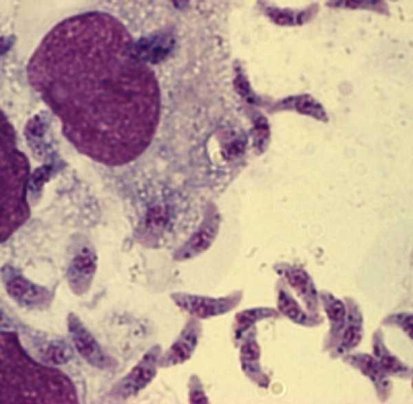 jpg Toxoplasma gondii http://www.smittskyddsinstitutet.
