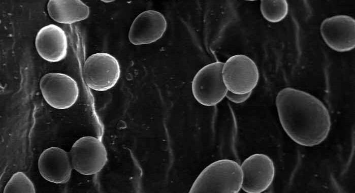 Saccharomyces cerevisiae www.