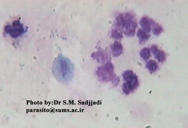 Trichomonas vaginalis Giemsa http://medschool.sums.ac.