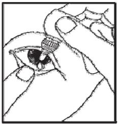 Obrázek 1 5. Kapátko lahvičky přibližte k léčenému oku a lehce stiskněte tak, abyste do oka vkápli jednu kapku. 6. Zašroubujte víčko zpět na lahvičku. 7.