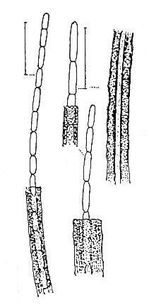 Leptothrix ochracea ODDĚLENÍ: BACTERIOPHYTA - baktérie Je to vláknitá, železitá baktérie, u níž se sraženina hydroxidu železitého (může být i mangan) ukládá v tlusté vrstvě na povrchu pochev.