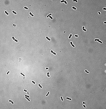 brevis RIBM ML10 nificantly increases the number of contaminating microorganisms.
