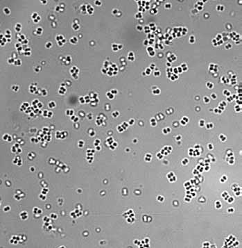 Lactic acid bacteria can damage the beer also secondarily, i.e. during the bottling into containers (the so-called secondary, i.e. post-pasteurization contamination).