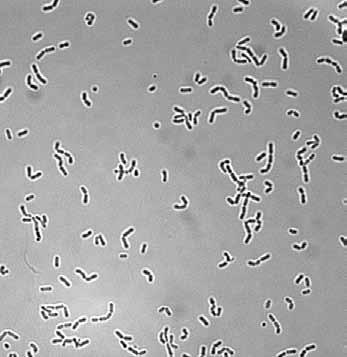 The damage of beer by lactic acid bacteria is characterized by turbidity, increased beer acidity, production of gas and undesirable flavor compounds (lactic acid, acetic acid, diacetyl, etc.