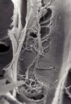 houby depolymerizace