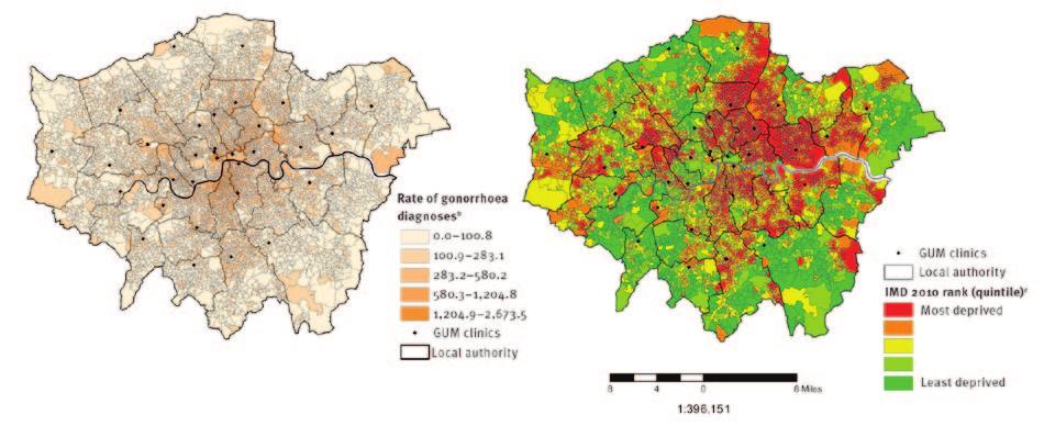 Obrázek 3 Umístění klinik zabývajících se léčbou sexuálně přenosných infekcí a a i) podíl diagnóz kapavky b podle oblasti LSOA (lower super output area) v roce 2013, a ii) index mnohonásobné