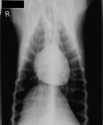 Klinické rysy RTG Aorta Plicní kmen Pravá síň Levá síň