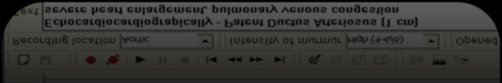 Kontinuální šelest Jak?