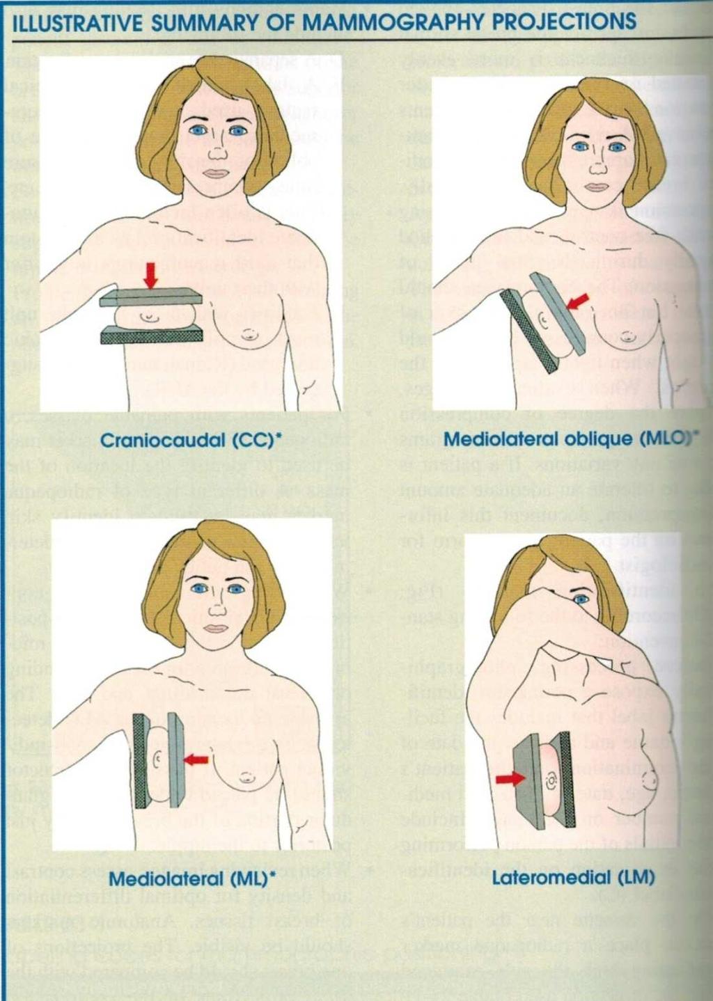 Příloha 5: Schématický přehled prováděných mamografických projekcí 1. část Zdroj: Eugene D. Frank, Bruce W. Long, Barbara J.