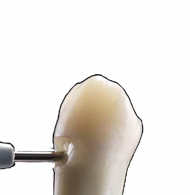 samonivelace a více než šest let klinických úspěchů,
