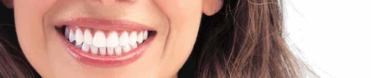 Ultradent Opalescence Go + Opalescence bělící pasta Univerzální předplněné nosiče s bělícím gelem, extra přiléhavý těsnější nosič nově i pro bělení distálních zubů, optimální naplnění nosiče gelem -
