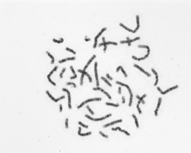 4.1 Segmentace obrazu Vstupem algoritmu je šedotónový obraz, v němž je před aplikací dalších metod nezbytné rozlišit samotné chromozomy a oddělit je od pozadí.