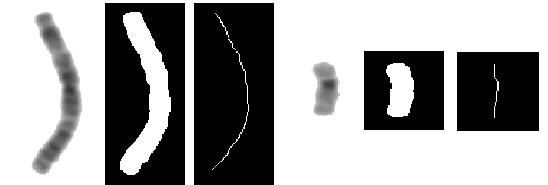 Obsah a délka chromozomů Obsah chromozomu odpovídá počtu bílých pixelů v binárním obraze chromozomu.