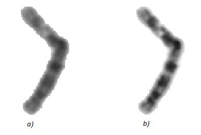 Obrázek 23: Zvýšení kontrastu šedotónového obrazu chromozomu a) originální verze, b) verze se zvýšeným kontrastem Jednotlivé kolmice jsou vytvořeny na základě lokálního sklonu podélné osy [11].