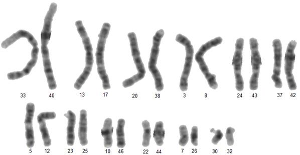 Obrázek 31: Chromozomy klasifikované do párů pomocí Pearsonova korelačního koeficientu, omezení výběru na 10%.