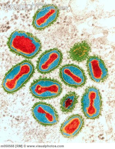 Virus varioly patogenní pouze pro člověka jediným rezervoárem člověk (nemá zvířecí rezervoár) zdrojem nákazy pouze