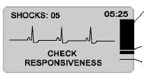 LCD displej ZOLL AED Plus je vybaven 3,3 6,6 cm LCD displejem (viz obr.