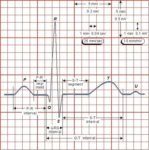 Obrázek 3: Elektrokardiogram Elektrokardiograf je ve své podstatě diferenční zesilovač se zesílením 1000. Napěťové měřítko je 10 mm/mv a časové 25 nebo 50 mm/s.
