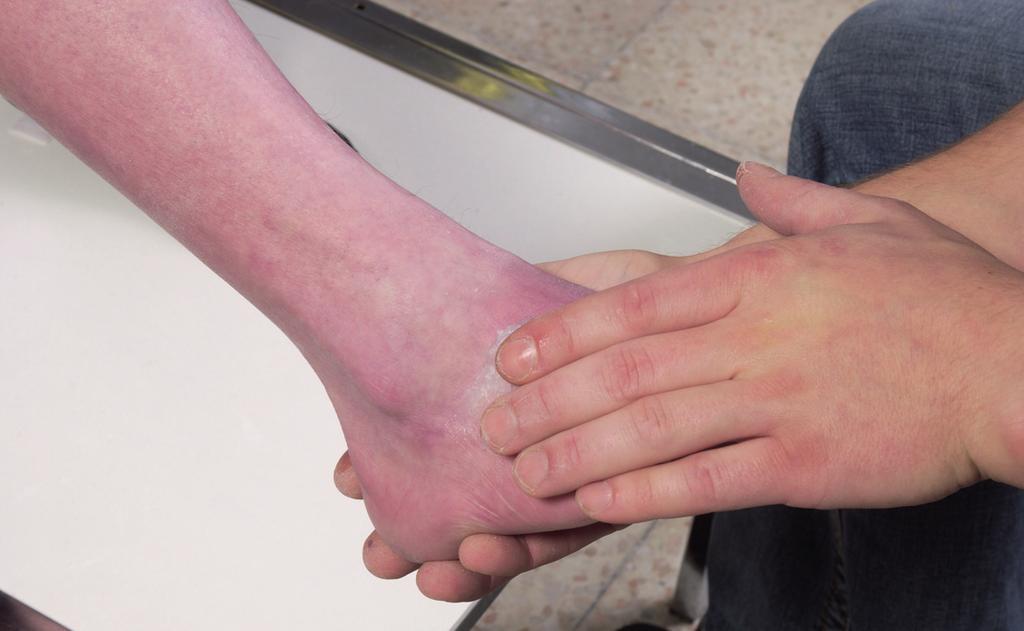 Průběh vybavení při výrobě silikonové protézy přednoží v odd.