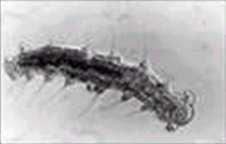 Aphanoneura Clitellata Scolecida