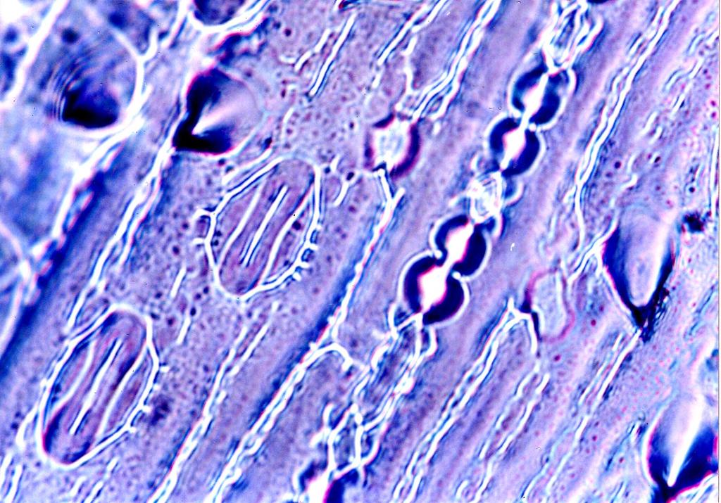 lamely) vedlejší buňky Stoma se svěracími buňkami piškotovitého tvaru typ Gramineae. Stomata umožňují výměnu plynů mezi ovzduším a mezofylem listů.