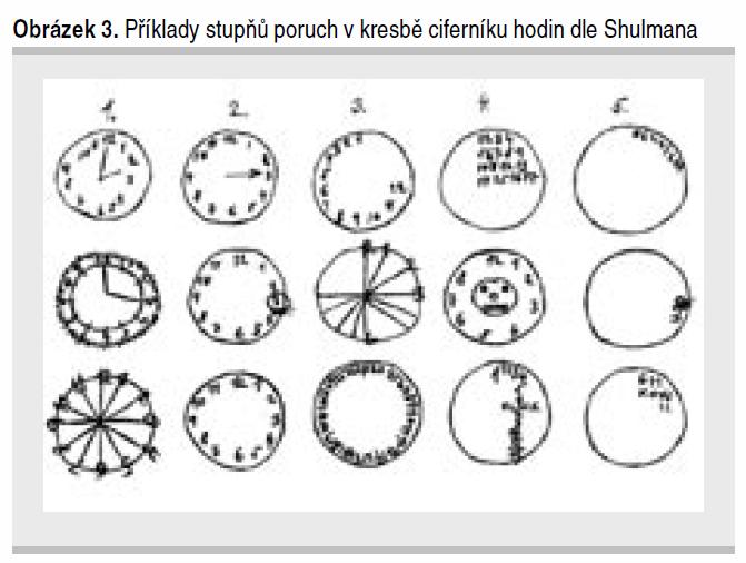 Test hodin, přehledná informace a zhodnocení škál dle