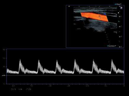 Technologie Differential Tissue Harmonics poskytuje obrazy s bezkonkurenčním