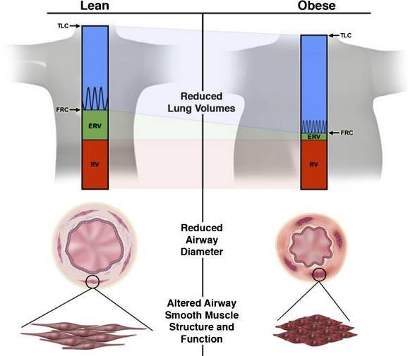 37 Účinky obezity na funkci plic, periferní