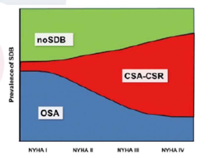 SDB u CHSS Prevalence SDB u CHSS 51-88% vyšší než v běžné populaci Jak u HFpEF tak u HFrEF nebo HFmrEF Relativní nedostatek typických symptomů (denní spavost) Poddiagnostikovanost CSA/CSR -