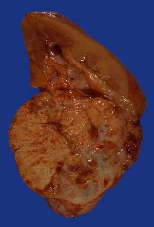 Kidney