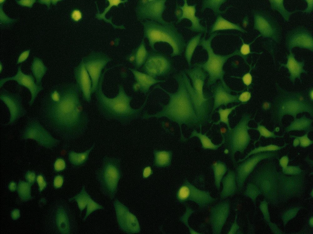 PHOTODYNAMIC THERAPY necrosis cell membrane ER Ca 2+ mitochondrion