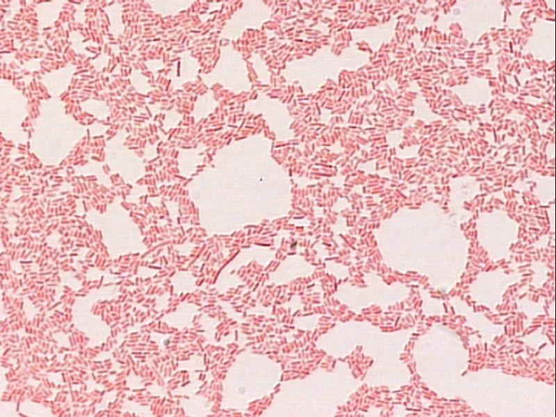 Escherichia coli hodná i zlá www2.