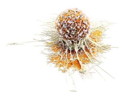 Cytostatika mechanismus účinku, terapie a