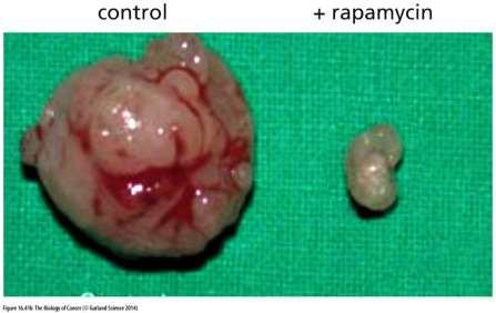 Regulační komplexy mtor-raptor a mtor-rictor jsou inaktivovány rapamycinem a jeho variantami pleiotropní antiproliferační a antiangiogenní efekt
