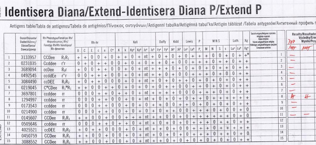 Obrázek 28: Identifikace na systému DG Gel. Identifikací jsme potvrdili detekce anti-lu a protilátky. Komerční erytrocyty běžně nemají na svém povrchu antigen Wr(a+). 3.