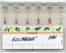 Tabulka 73: Testování vzorku se specifickými panelovými erytrocyty Panelový dárci erytrocytů 4 C zkumavka NAT sloup.aglu