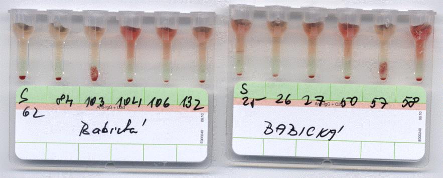 Tabulka 39: NAT s erytrocyty s LFA antigeny KS Číslo vzorku antigen Výsledek NAT Kontrola 0 S25 Tr a Negativní Negativní 0 S26 Cx Negativní Negativní 0 S27 Damton Negativní Negativní 0 S50