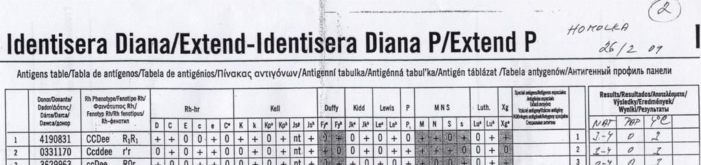 Krevní skupina: AB RhD pozitivní Fenotyp: Ccee, Cw negativní, Kk, Jk(a+b-) Tabulka 53: Primární vyšetření testu Test Přímý antiglobulinový test NaCl test (4 C ) Enzymatický test v solném prostředí