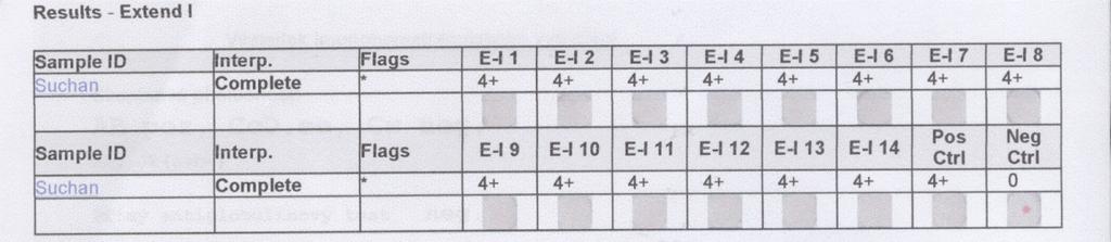1. krok: Stanovení chladových protilátek Vyšetřili jsme vzorek na přítomnost chladových protilátek. Při 4 C jsme detekovali slabě pozitivní reakce (viz tabulka 58).