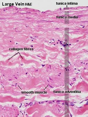 Žíly velkého průsvitu tunica intima fragmentovaná lamina elastica