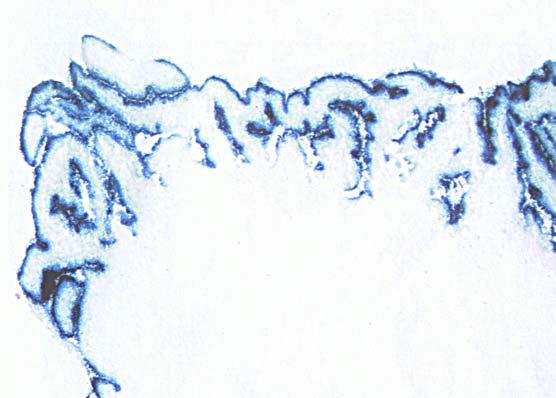 ENTEROCYTU IMUNOHISTOCHEMICKÁ DETEKCE 38 MODERNÍ