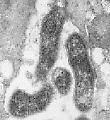 European Helicobacter Pylori Study Group Current Concepts in the Management of Helicobacter pylori Infection The Maastricht 2-20002 2000 Consensus Report September 2000 KOHO LÉČIT - EHPSG