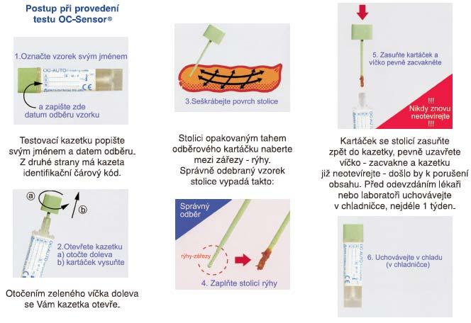OC-SENZOR, POSTUP PROVEDENÍ Í